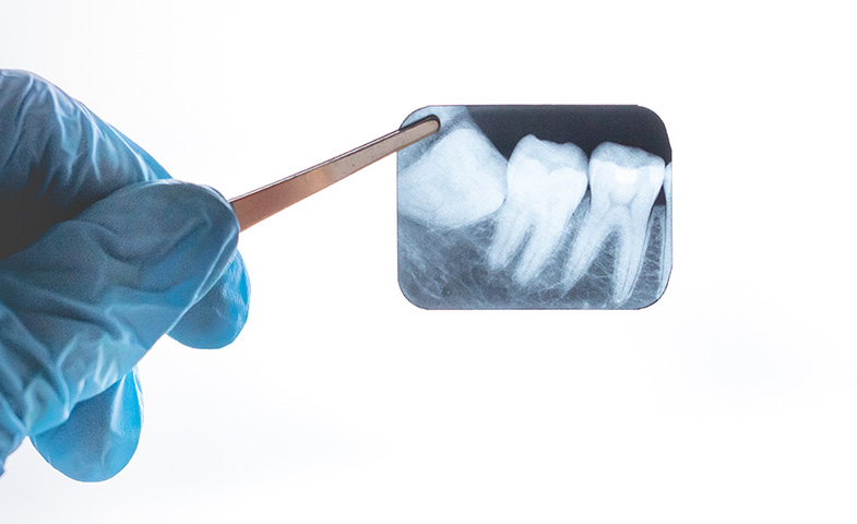 東京都港区新橋の親知らず抜歯専門の歯医者・歯科【東京新橋歯科口腔外科】は親知らずの抜歯に特化したクリニック